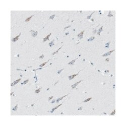 WBSCR17, Rabbit, Polyclonal Antibody, Abnova 100&mu;L; Unlabeled:Antibodies,