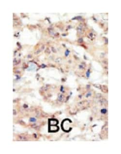 EPHB6 Rabbit anti-Human, Polyclonal Antibody, Abnova 400&mu;L; Unlabeled:Antibodies,