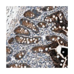 LPIN2, Rabbit, Polyclonal Antibody, Abnova 100 &mu;L | Buy Online | Abnova Corporation | Fisher Scientific