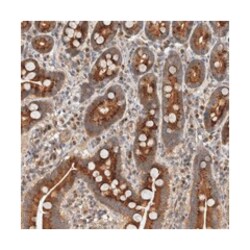 IQCK, Rabbit, Polyclonal Antibody, Abnova 100&mu;L; Unlabeled:Antibodies,