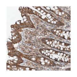 SLC1A5 Rabbit anti-Human, Polyclonal Antibody, Abnova 100&mu;L; Unlabeled:Antibodies,