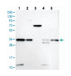 VPS37B, Rabbit, Polyclonal Antibody, Abnova 100 &mu;L | Buy Online | Abnova Corporation | Fisher Scientific