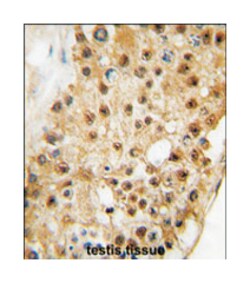 ELP3 Rabbit anti-Human, Polyclonal Antibody, Abnova 400 &mu;L | Buy Online | Abnova Corporation | Fisher Scientific
