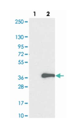 ADO Rabbit anti-Human, Polyclonal Antibody, Abnova 100 &mu;L | Buy Online | Abnova Corporation | Fisher Scientific