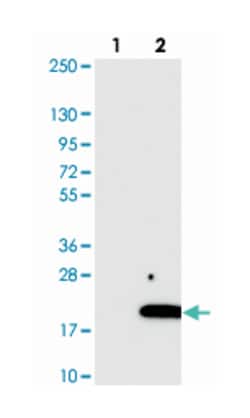 C2orf76, Rabbit, Polyclonal Antibody, Abnova 100 &mu;L | Buy Online | Abnova Corporation | Fisher Scientific