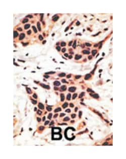 HRK Rabbit anti-Human, Mouse, Polyclonal Antibody, Abnova 400 &mu;L | Buy Online | Abnova Corporation | Fisher Scientific