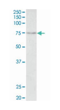 SLC6A4 Goat anti-Mouse, Polyclonal Antibody, Abnova 100 &mu;g | Buy Online | Abnova Corporation | Fisher Scientific