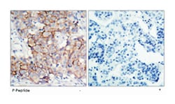 ERBB2 (phospho Y877), Rabbit anti-Human, Mouse, Rat, Polyclonal Antibody,