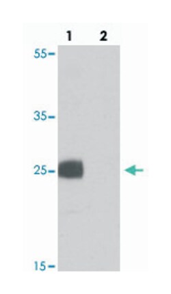 EMX1, Chicken, Polyclonal Antibody, Abnova 100 &mu;g | Buy Online | Abnova Corporation | Fisher Scientific