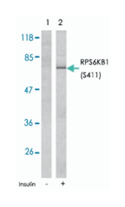 RPS6KB1 (phospho S411), Rabbit anti-Human, Mouse, Rat, Polyclonal Antibody, Abnova 100 &mu;g | Buy Online | Abnova | Fisher Scientific