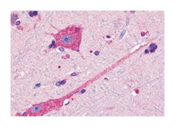 DRD2 Rabbit anti-Bovine, Dog, Horse, Human, Rabbit, Polyclonal Antibody, Abnova 50 &mu;g | Buy Online | Abnova Corporation | Fisher Scientific