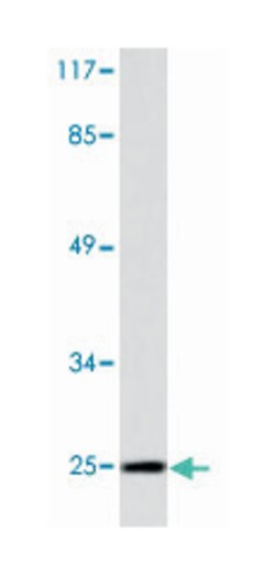 CLDN10 Rabbit anti-Human, Mouse, Polyclonal Antibody, Abnova&trade;