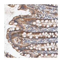 NSUN7, Rabbit, Polyclonal Antibody, Abnova 100&mu;L; Unlabeled:Antibodies,