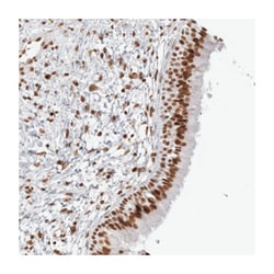 KIF18B Rabbit anti-Human, Polyclonal Antibody, Abnova 100&mu;L; Unlabeled:Antibodies,