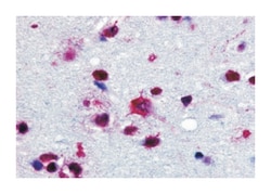 PYGB Rabbit anti-Human, Monkey, Rabbit, Polyclonal Antibody, Abnova 50 &mu;g | Buy Online | Abnova Corporation | Fisher Scientific