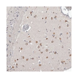 C1orf50, Rabbit, Polyclonal Antibody, Abnova 100 &mu;L | Buy Online | Abnova Corporation | Fisher Scientific