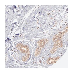 IMPDH2, Rabbit, Polyclonal Antibody, Abnova 100&mu;L; Unlabeled:Antibodies,