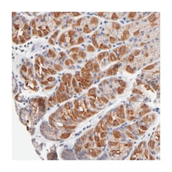 FBXO8, Rabbit, Polyclonal Antibody, Abnova 100&mu;L; Unlabeled:Antibodies,