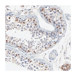 NXF3 Rabbit anti-Human, Polyclonal Antibody, Abnova 100 &mu;L | Buy Online | Abnova | Fisher Scientific