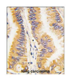 FRAT1 Rabbit anti-Human, Polyclonal Antibody, Abnova 400&mu;L; Unlabeled:Antibodies,