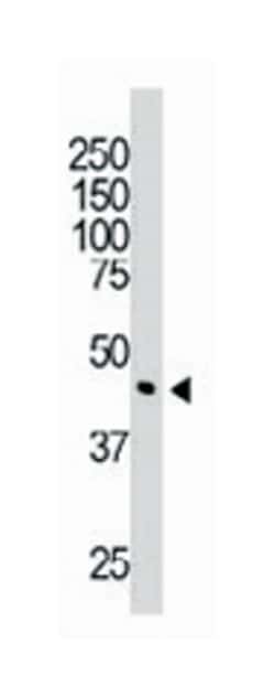 DOK2 Rabbit anti-Human, Polyclonal Antibody, Abnova 400&mu;L; Unlabeled:Antibodies,