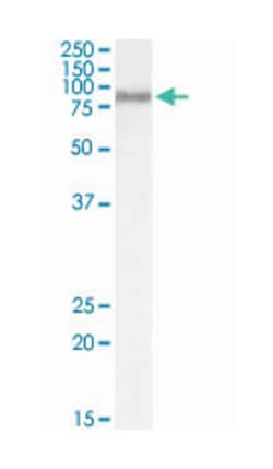 ACSL4, Goat, Polyclonal Antibody, Abnova 100&mu;g; Unlabeled:Antibodies,