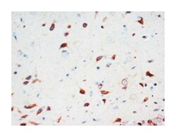 SCG3, Rabbit, Polyclonal Antibody, Abnova 100&mu;g; Unlabeled:Antibodies,