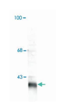 Cacng2 Rabbit anti-Mouse, Rat, Polyclonal Antibody, Abnova 100&mu;L; Unlabeled:Antibodies,