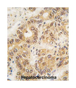ZIC3, Rabbit, Polyclonal Antibody, Abnova 400&mu;L; Unlabeled:Antibodies,