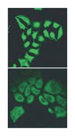 SPG20, Goat, Polyclonal Antibody, Abnova 100&mu;g; Unlabeled:Antibodies,