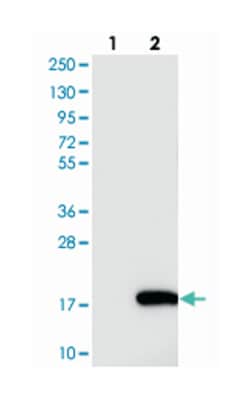 NRARP, Rabbit, Polyclonal Antibody, Abnova 100 &mu;L | Buy Online | Abnova Corporation | Fisher Scientific