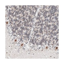 KIF2B Rabbit anti-Human, Polyclonal Antibody, Abnova 100 &mu;L | Buy Online | Abnova Corporation | Fisher Scientific