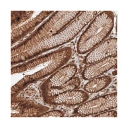 ZNF660, Rabbit, Polyclonal Antibody, Abnova 100&mu;L; Unlabeled:Antibodies,