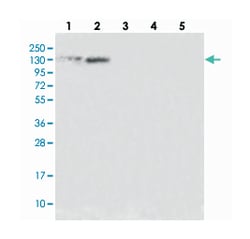 SR140, Rabbit, Polyclonal Antibody, Abnova 100 &mu;L | Buy Online | Abnova Corporation | Fisher Scientific