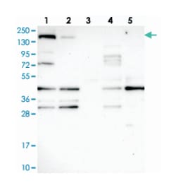 SH3TC1, Rabbit, Polyclonal Antibody, Abnova 100&mu;L; Unlabeled:Antibodies,