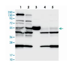 C11orf84, Rabbit, Polyclonal Antibody, Abnova 100 &mu;L | Buy Online | Abnova Corporation | Fisher Scientific