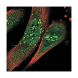 AP3B2 Rabbit anti-Human, Polyclonal Antibody, Abnova 100 &mu;L | Buy Online | Abnova Corporation | Fisher Scientific
