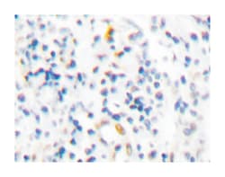 PML Rabbit anti-Human, Polyclonal Antibody, Abnova 100 &mu;L | Buy Online | Abnova Corporation | Fisher Scientific