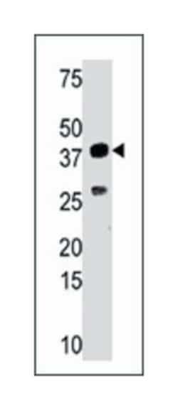SULT1C4, Rabbit, Polyclonal Antibody, Abnova 400 &mu;L | Buy Online | Abnova Corporation | Fisher Scientific