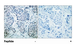 MAP2K4 (phospho T261), Rabbit anti-Human, Mouse, Rat, Polyclonal Antibody, Abnova 100 &mu;g | Buy Online | Abnova | Fisher Scientific