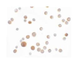 SLC35D2, Rabbit, Polyclonal Antibody, Abnova 100&mu;g; Unlabeled:Antibodies,