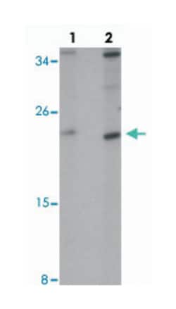 TMEM147, Rabbit, Polyclonal Antibody, Abnova 100&mu;g; Unlabeled:Antibodies,
