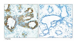 PAK1/PAK2/PAK3 (phospho T423/T402/T421), Rabbit anti-Human, Mouse, Rat,