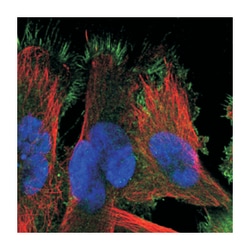 SLC10A5, Rabbit, Polyclonal Antibody, Abnova 100 &mu;L | Buy Online | Abnova Corporation | Fisher Scientific