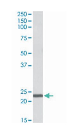 IL15, Goat, Polyclonal Antibody, Abnova 100 &mu;g | Buy Online | Abnova Corporation | Fisher Scientific
