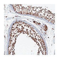 REP15, Rabbit, Polyclonal Antibody, Abnova 100 &mu;L | Buy Online | Abnova | Fisher Scientific