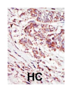 CAMK1G, Rabbit, Polyclonal Antibody, Abnova 400 &mu;L | Buy Online | Abnova Corporation | Fisher Scientific