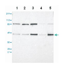 IRF9, Rabbit, Polyclonal Antibody, Abnova 100&mu;L; Unlabeled:Antibodies,