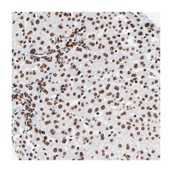 ZNF544, Rabbit, Polyclonal Antibody, Abnova 100&mu;L; Unlabeled:Antibodies,