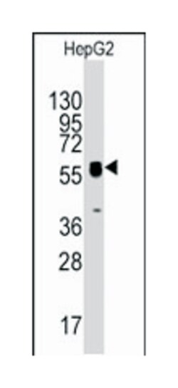 TYMP, Rabbit, Polyclonal Antibody, Abnova 400 &mu;L | Buy Online | Abnova Corporation | Fisher Scientific